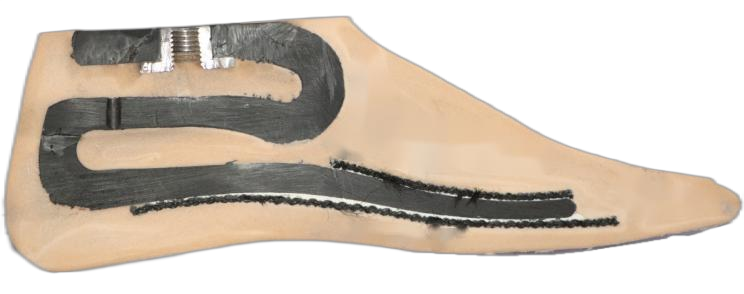 Prosthetic foot Carbon fiber composite material energy storage foot Size 22–27